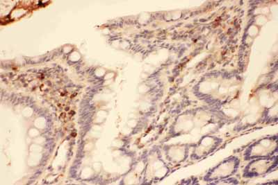 2 - Anti-MMP-7 Antibody ABO11761