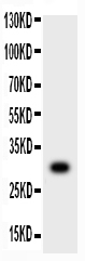 1 - Anti-MMP-7 Antibody ABO11761