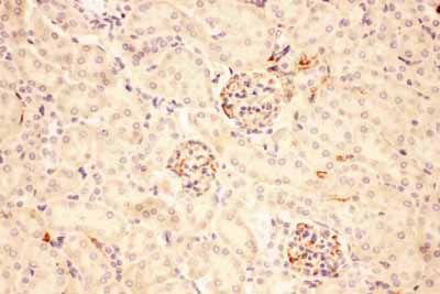 2 - Anti-ACTH Picoband Antibody ABO11762