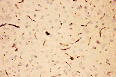 2 - Anti-ACTH Picoband Antibody ABO11762
