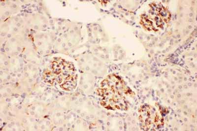 2 - Anti-ACTH Picoband Antibody ABO11762