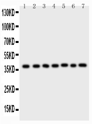 1 - Anti-ARA9 Picoband Antibody ABO11763