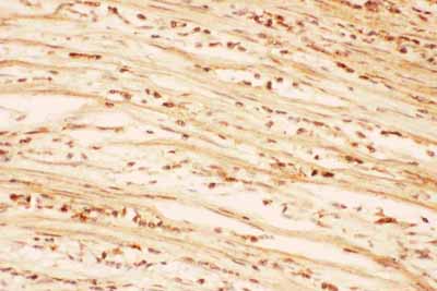 2 - Anti-AKT2 Picoband Antibody ABO11764