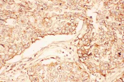 2 - Anti-AKT2 Picoband Antibody ABO11764