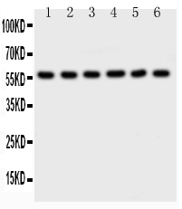 1 - Anti-AKT2 Picoband Antibody ABO11764