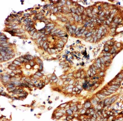 2 - Anti-Calbindin Picoband Antibody ABO11766