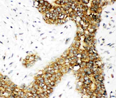 2 - Anti-Calbindin Picoband Antibody ABO11766