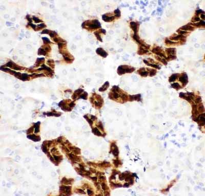 2 - Anti-Calbindin Picoband Antibody ABO11766
