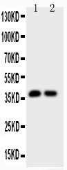 1 - Anti-Calbindin Picoband Antibody ABO11766
