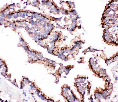 2 - Anti-Cathepsin D Picoband Antibody ABO11768