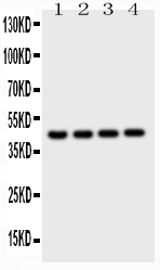 1 - Anti-Cathepsin D Picoband Antibody ABO11769