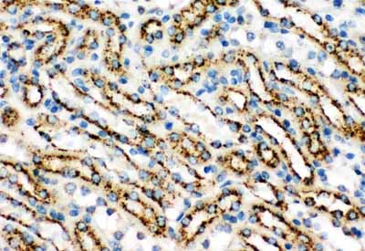 2 - Anti-Cathepsin D Picoband Antibody ABO11769