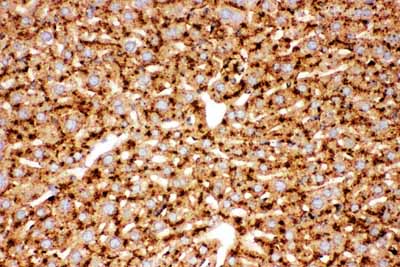 2 - Anti-Cathepsin D Picoband Antibody ABO11769