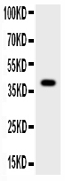1 - Anti-Cathepsin G Picoband Antibody ABO11770