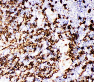 2 - Anti-CD20 Picoband Antibody ABO11771