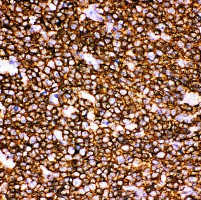 2 - Anti-CD20 Picoband Antibody ABO11771