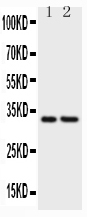1 - Anti-CD20 Picoband Antibody ABO11771