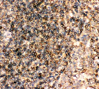 2 - Anti-CD23/FCER2 Antibody ABO11772