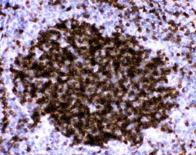 2 - Anti-CD23/FCER2 Antibody ABO11772