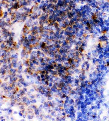 2 - Anti-CD23/FCER2 Antibody ABO11772