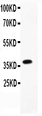 1 - Anti-CD23/FCER2 Antibody ABO11772