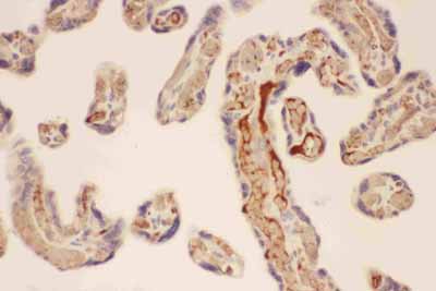 2 - Anti-CMA1 Picoband Antibody ABO11774
