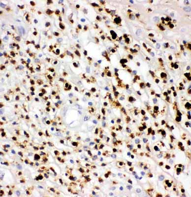 2 - Anti-MPO Antibody ABO11775