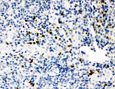 2 - Anti-MPO Antibody ABO11775