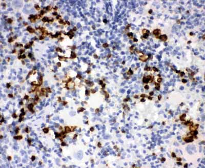 2 - Anti-MPO Antibody ABO11775