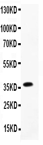 1 - Anti-MPO Antibody ABO11775