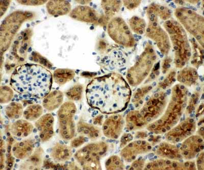 2 - Anti-CD10/Neprilysin Antibody ABO11776