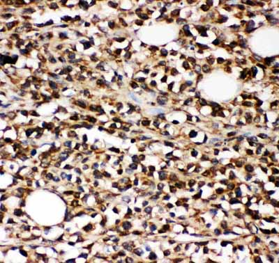 2 - Anti-CD10/Neprilysin Antibody ABO11776