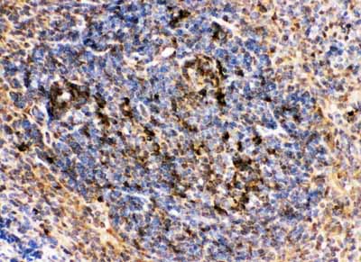 2 - Anti-CD10/Neprilysin Antibody ABO11776