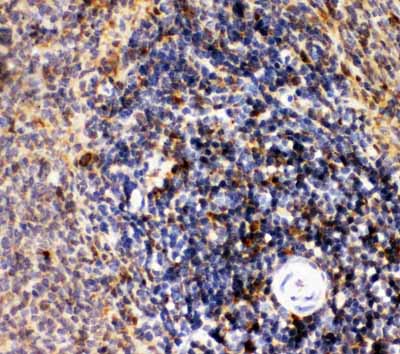 2 - Anti-CD10/Neprilysin Antibody ABO11776