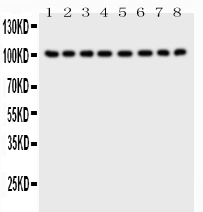 1 - Anti-CD10/Neprilysin Antibody ABO11776