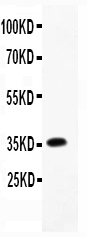 1 - Anti-CCL4/MIP-1 beta Antibody ABO11780