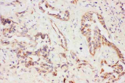 2 - Anti-Eotaxin 3 Picoband Antibody ABO11782