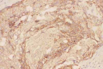 2 - Anti-Eotaxin 3 Picoband Antibody ABO11782