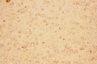 2 - Anti-CNTF Picoband Antibody ABO11783