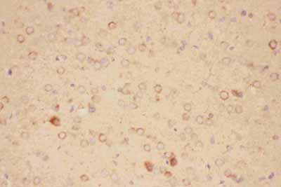 2 - Anti-CNTF Picoband Antibody ABO11783