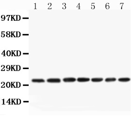 1 - Anti-CNTF Picoband Antibody ABO11783