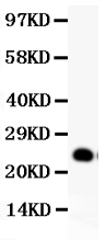 1 - Anti-GDNF Picoband Antibody ABO11785