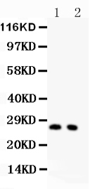 1 - Anti-P27 KIP 1 Picoband Antibody ABO11786
