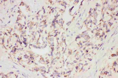 2 - Anti-VEGF Picoband Antibody ABO11787