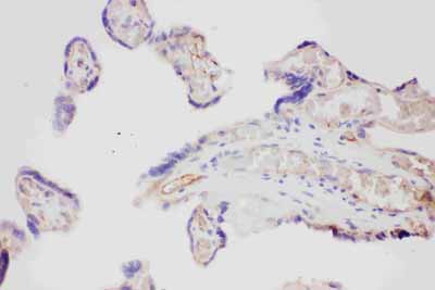 2 - Anti-VEGF Picoband Antibody ABO11787