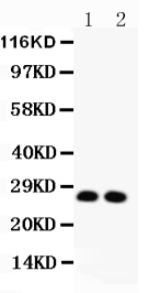 1 - Anti-VEGF Picoband Antibody ABO11787