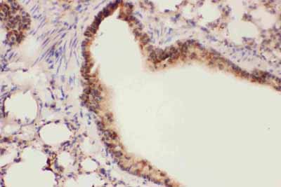 2 - Anti-ALOX15 Picoband Antibody ABO11788