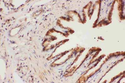 2 - Anti-ALOX15 Picoband Antibody ABO11788