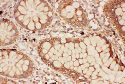 2 - Anti-ALOX15 Picoband Antibody ABO11788