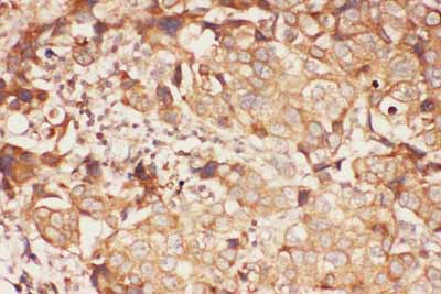 2 - Anti-ALOX15 Picoband Antibody ABO11788